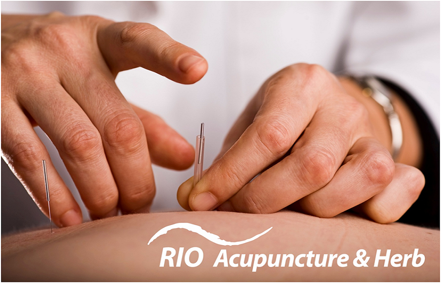 Acupuncture