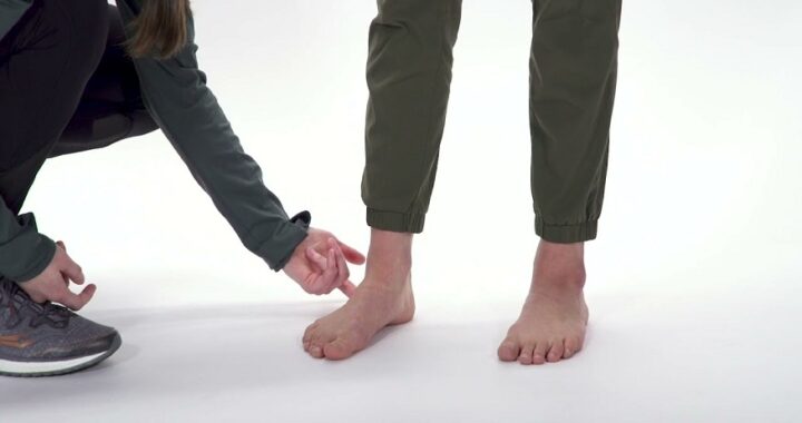 High Arches