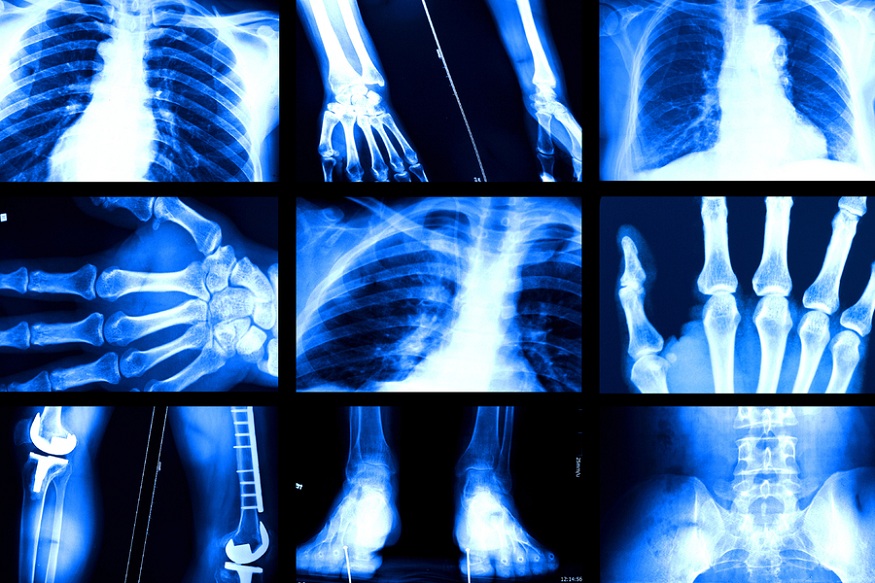 best medical imaging analysis