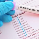Key Breast Cancer Biomarkers: A Comprehensive Guide