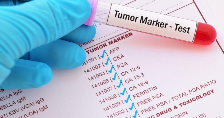 tumor marker test
