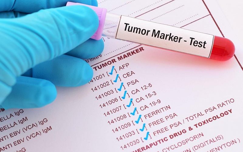 tumor marker test
