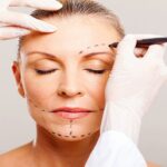 Reasons To Undergo Deep Plane Facelift