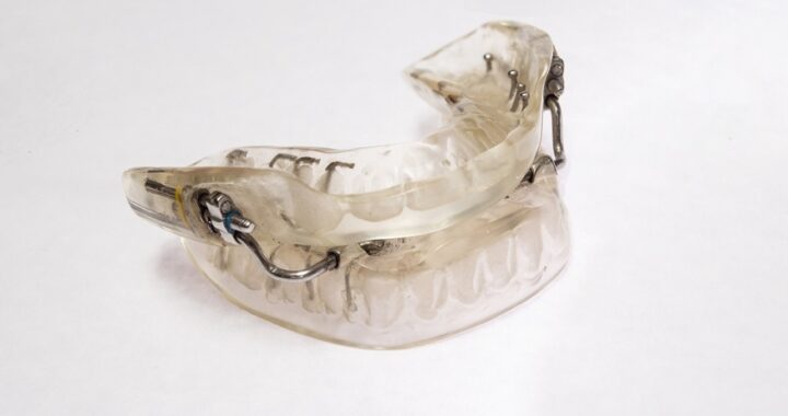 Oral Appliance