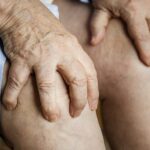 Osteoarthritis: Symptoms, Causes, and Remediation