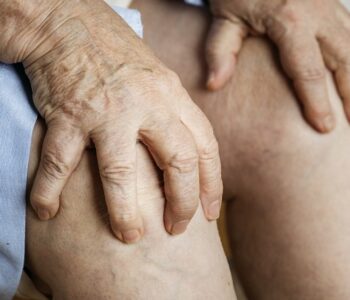 degenerative osteoarthritis