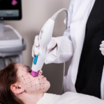 Why Is Thermage FLX So Expensive in Singapore