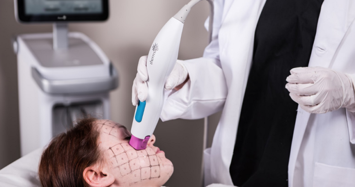 Thermage FLX So Expensive