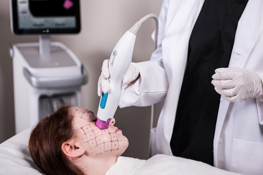 Thermage FLX So Expensive