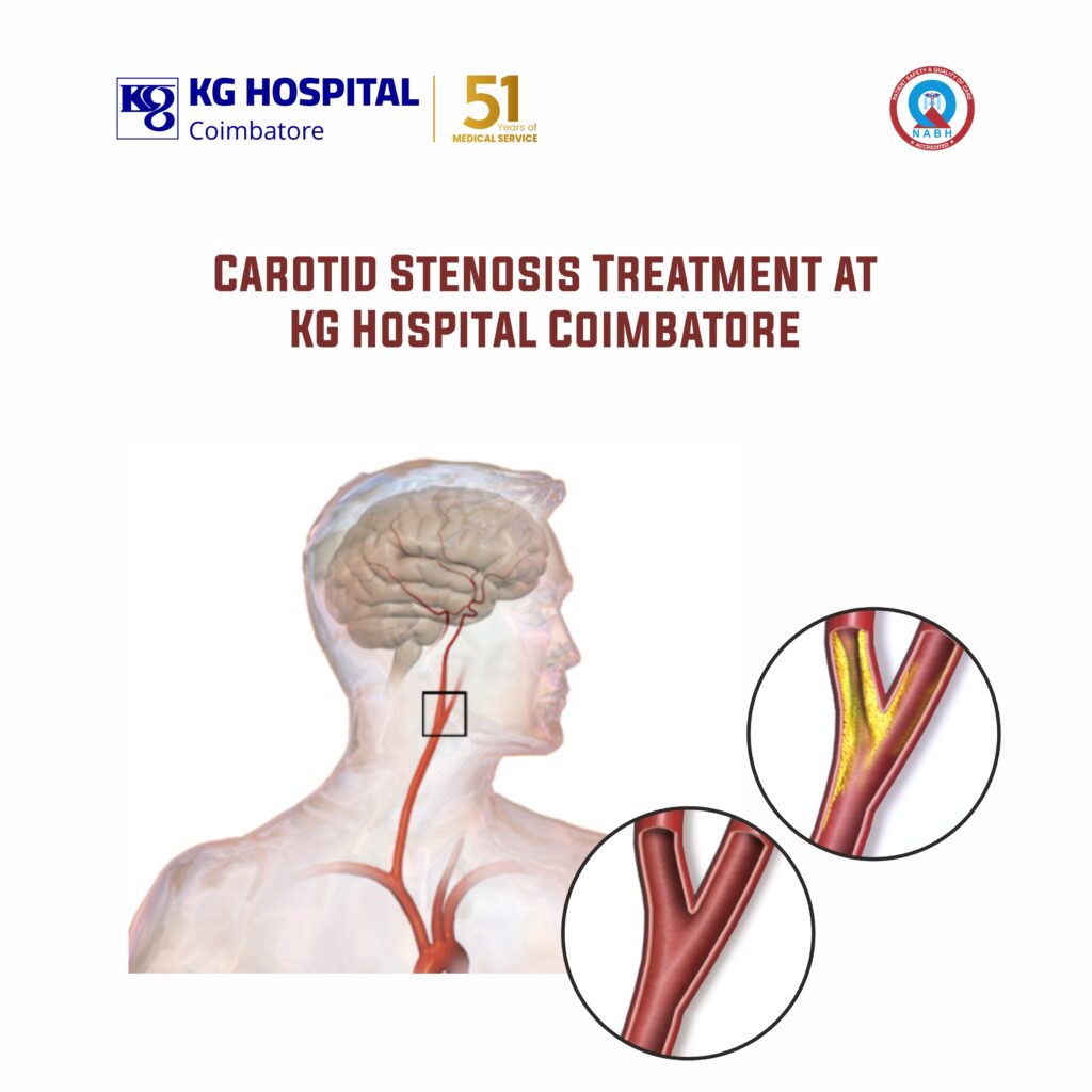 Carotid Stenosis