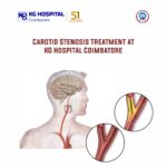 Carotid stenosis