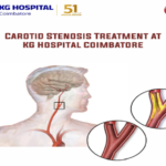 Carotid stenosis