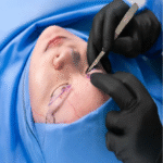 Eyelid Surgery Toronto: Expert Care at Eye FACE Institute