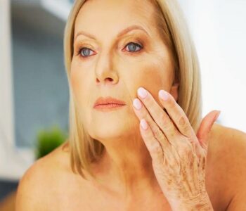 Crepey Skin Develops