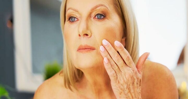 Crepey Skin Develops
