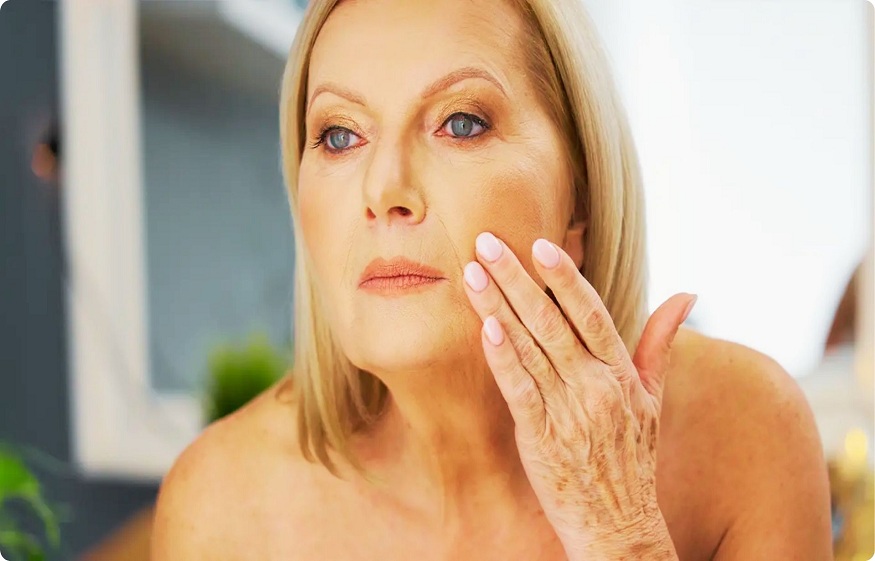 Crepey Skin Develops